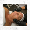 Brightening chemical Peel